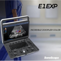 Portable Colour Doppler Machine E1Exp Sonoscape