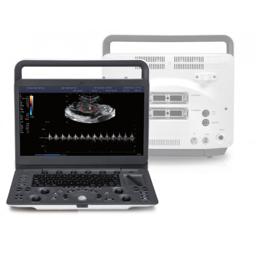 Veterinary Colour doppler Ultrasound machine E2V