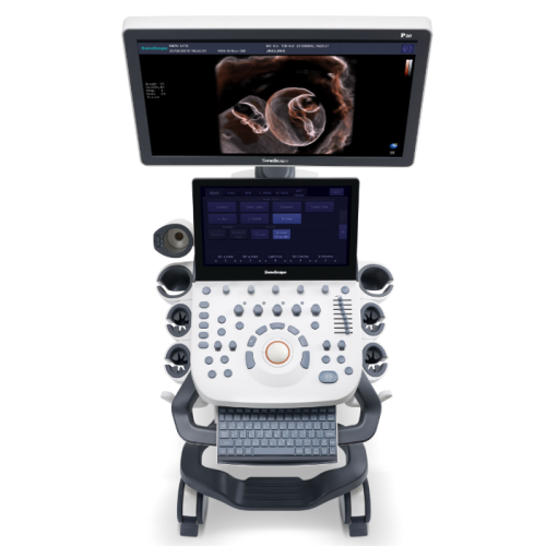 P20 Colour Doppler Ultrasound System for Obstetrics and Gynecology